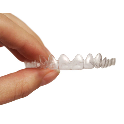 How Long Do You Have to Wear Invisalign?
